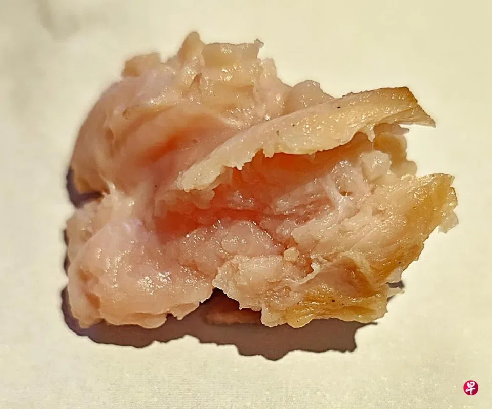 Ms Liang found the chicken pieces to be undercooked after having trouble chewing two of them.