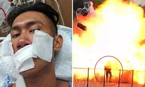 Taxi explodes at Commonwealth Ave: SCDF hero caught in blast recovering, praised by PM Lee