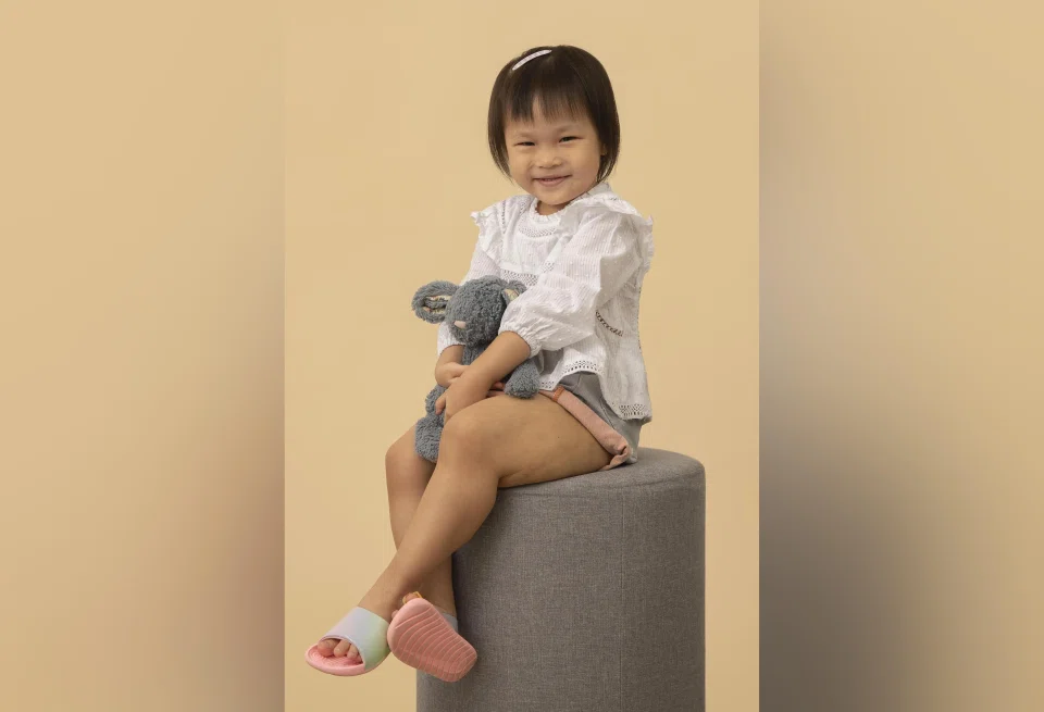 Before Cassie Chow, now five, was born, it was already obvious from pregnancy scans that her left leg was much bigger than her right.