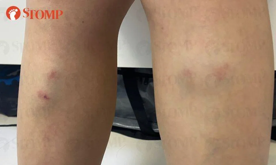 SBS Transit bus captain braked 'so hard' that passengers were flung forward and injured