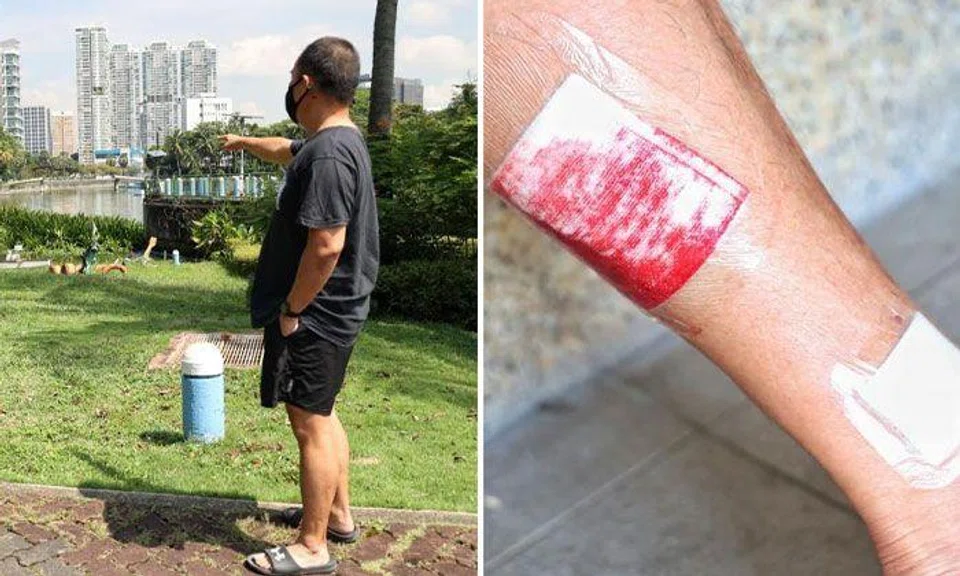 An adult otter lunged at Mr Ang and bit him on the calf at Kallang Riverside Park on April 4, 2022. PHOTOS: SHIN MIN DAILY NEWS