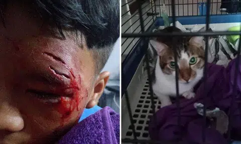SPCA strongly advises cat owners to sterilise their pets after boy gets attacked by family cat