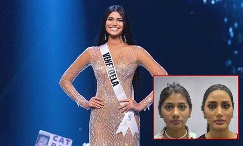 Cosmetic surgery photos of Miss Venezuela go viral after she becomes Miss Universe 2018 2nd runner-up
