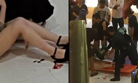 Pieces of flesh left dangling at woman's calf after dislodged escalator metal plate cuts her in Malaysian shopping mall