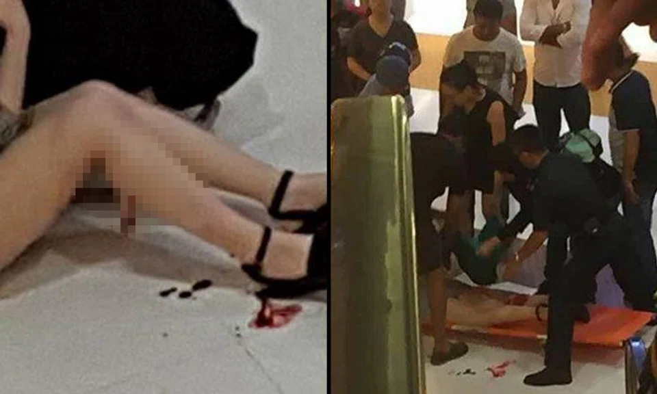 Pieces of flesh left dangling at woman's calf after dislodged escalator metal plate cuts her in Malaysian shopping mall