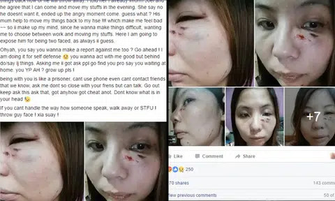 Woman claims ex-BF beat her and slashed her with knife during argument, posts photos of injuries on Facebook