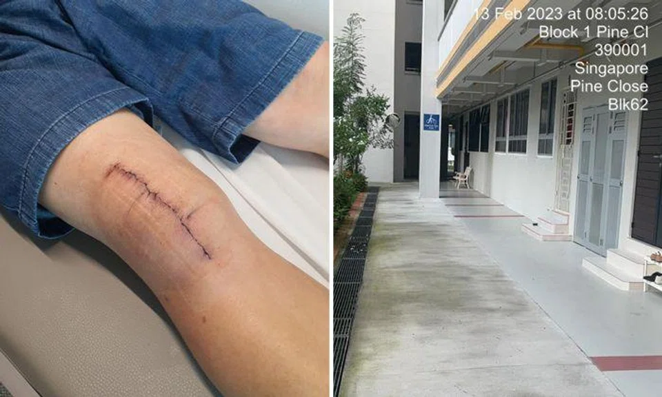 Man breaks kneecap and 'suffers great pain' after fall along slippery HDB corridor in Geylang