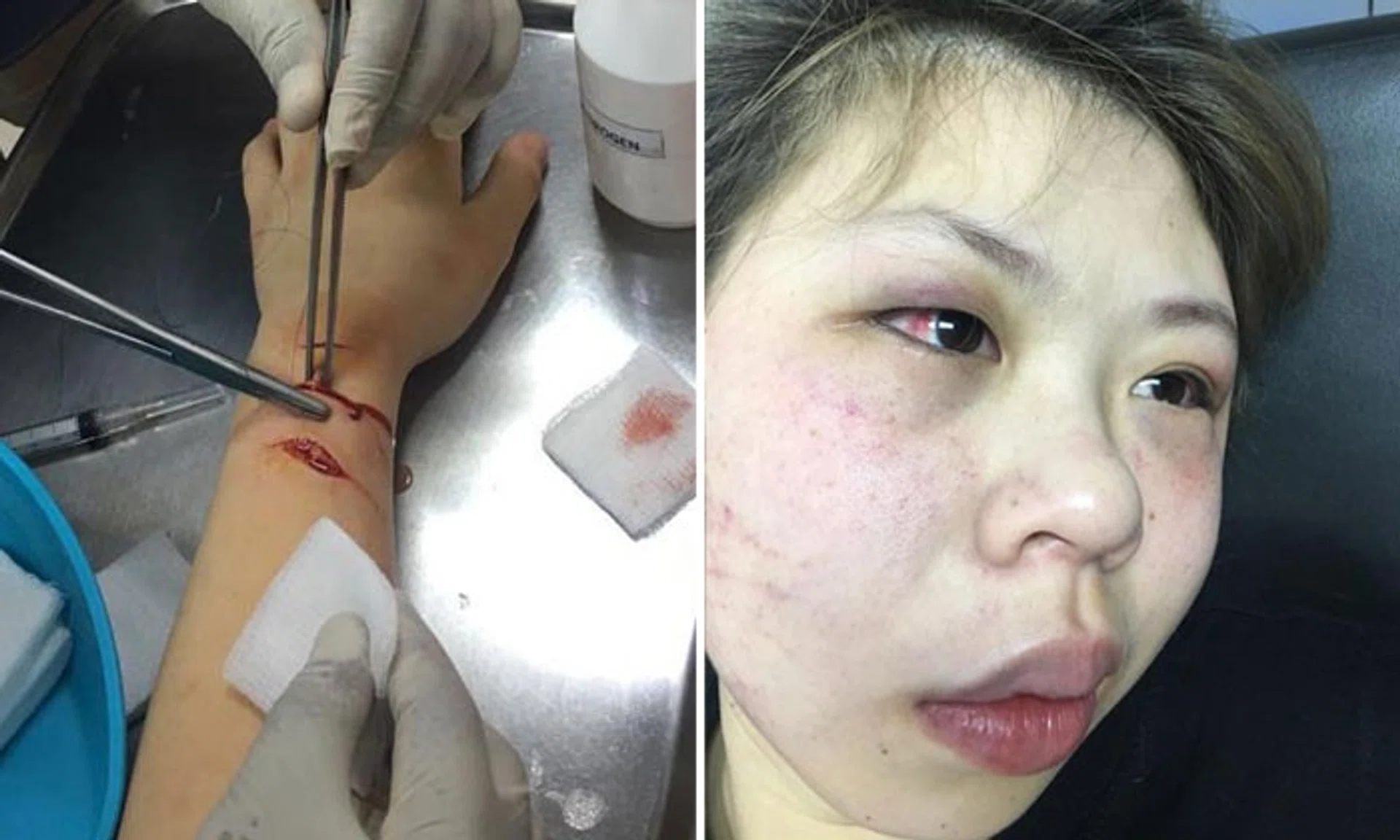 Woman shares terrifying experience of getting assaulted and slashed