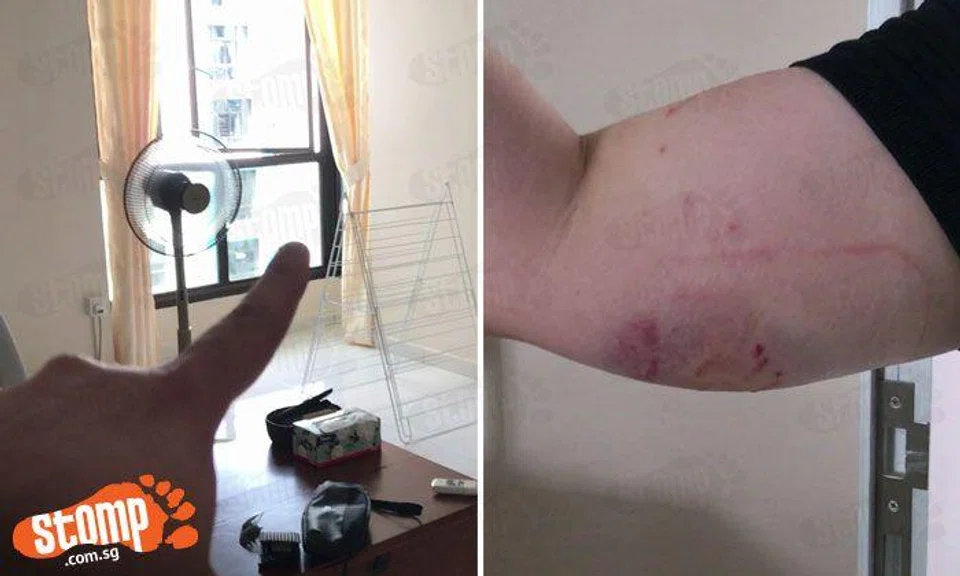 Left: Window where the monkey came into the Stomper Zenn's house. Right: Injuries sustained by Stomper Zenn