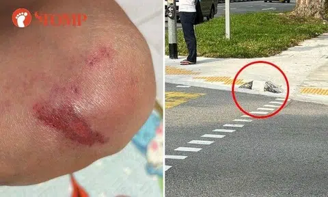 An elderly woman was injured after tripping over a "weird" kerb at a Woodlands junction on Sept 5.