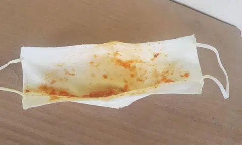 Nursing home investigating complaint that elderly woman was made to wear mask soiled with vomit