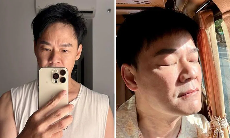 Thomas Ong admits letting himself go until 'everything on his face collapsed', goes for laser