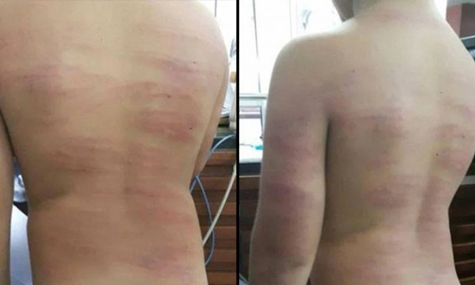 Thai teacher canes 7-year-old student 99 times for requesting an early dismissal 