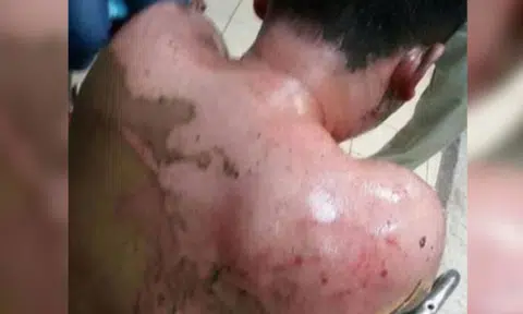 Man in Malaysia beaten up and scalded with hot water after going out with soon-to-be divorced woman