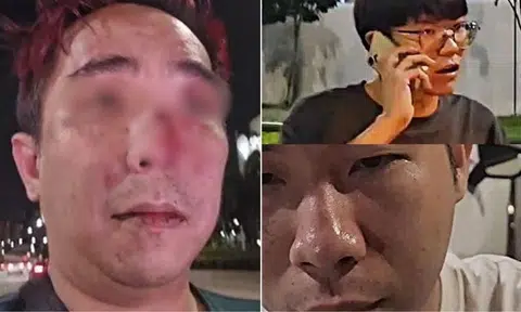 grab driver assaulted after trying to break up fight between passengers 