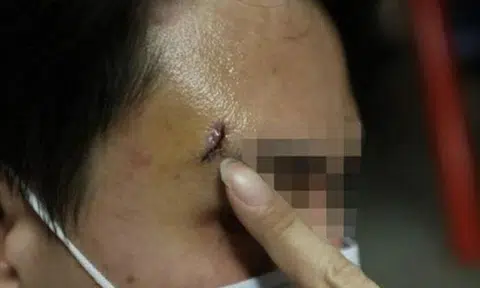 Man attacks diner at Geylang eatery with coffee mug after he refuses to buy one of his keychains