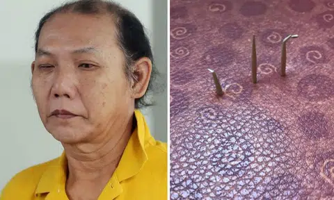 Landscape technician who stuck toothpicks in bus seats fined $3,600, ordered to pay $326 compensation