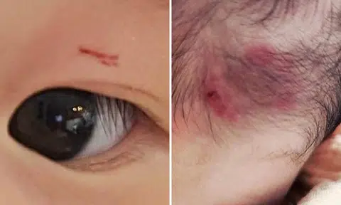 Twin girls get bitten at My First Skool in CCK: 'It's really outrageous'
