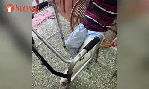 The Stomper shared a photo of her father's left leg in a cast.