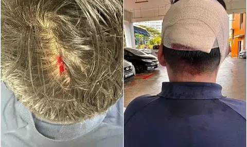 The school, Admiralty Secondary, said it is aware of the incident, which resulted in a cut on the victim’s head. 