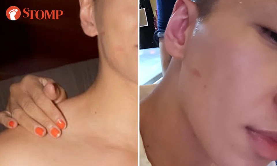 kissed without consent at pageant