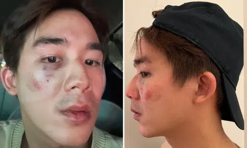 Actor Danny Lee accused of peeking at couple in parked car, gets kicked and punched by man