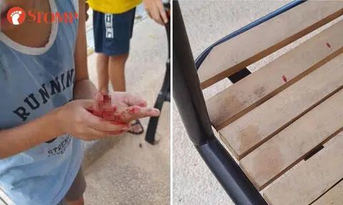 Town council cordons off Bishan swing after boy’s fingertip sliced off, trying to contact family