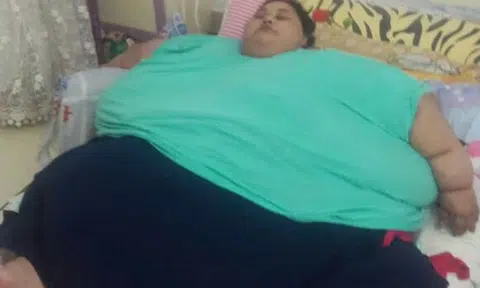 'World's heaviest' woman at 500kg flies to India for weight reduction surgery