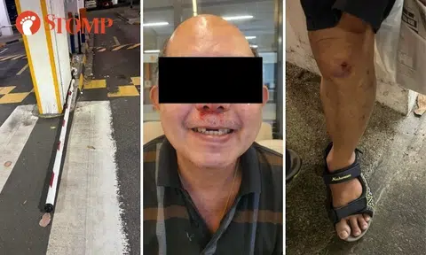 Man taken to hospital after tripping over carpark barrier knocked down by PMD rider in Hougang