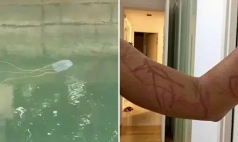 At least 2 people, including 4-year-old girl, stung by deadly box jellyfish