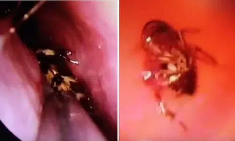 Screenshot from Youtube/SWNS