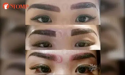 Woman 'disfigured' after going for home-based eyebrow embroidery procedure