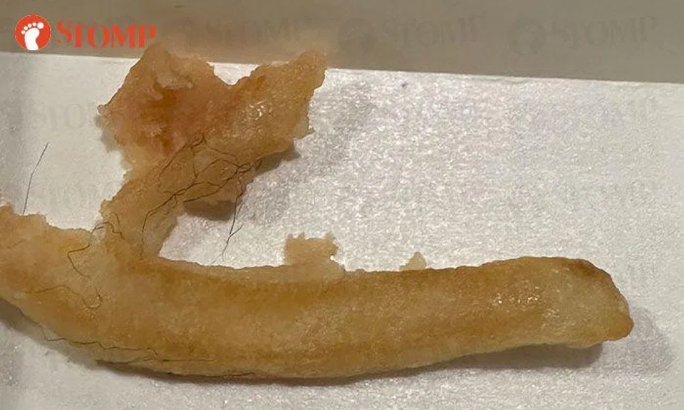 Girl vomits after finding 'hair clumps' in fries at McDonald's Bendemeer