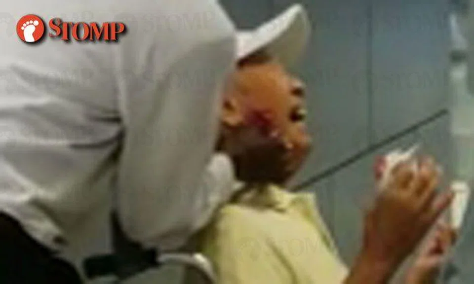 90-year-old uncle in wheelchair left bleeding after getting bitten by man at ONE KM