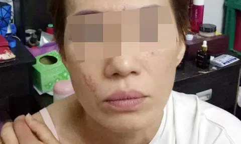 Photo: Shin Min Daily News