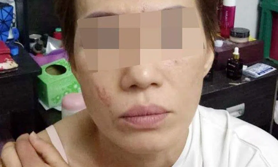 Photo: Shin Min Daily News