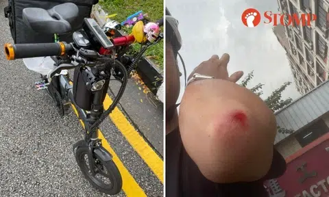 E-biker hurt after braking suddenly to avoid car and skidding 50m on Upper Paya Lebar Road