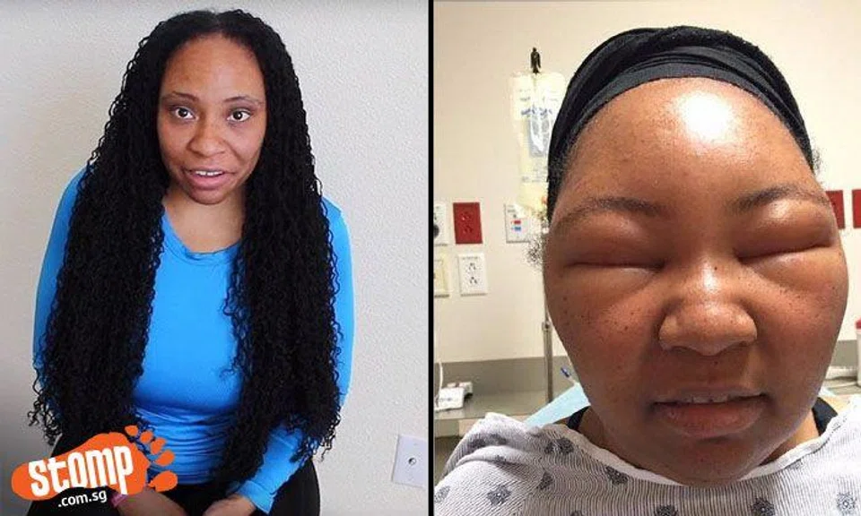 Woman horrified by what happens to her face after getting hair dyed at salon