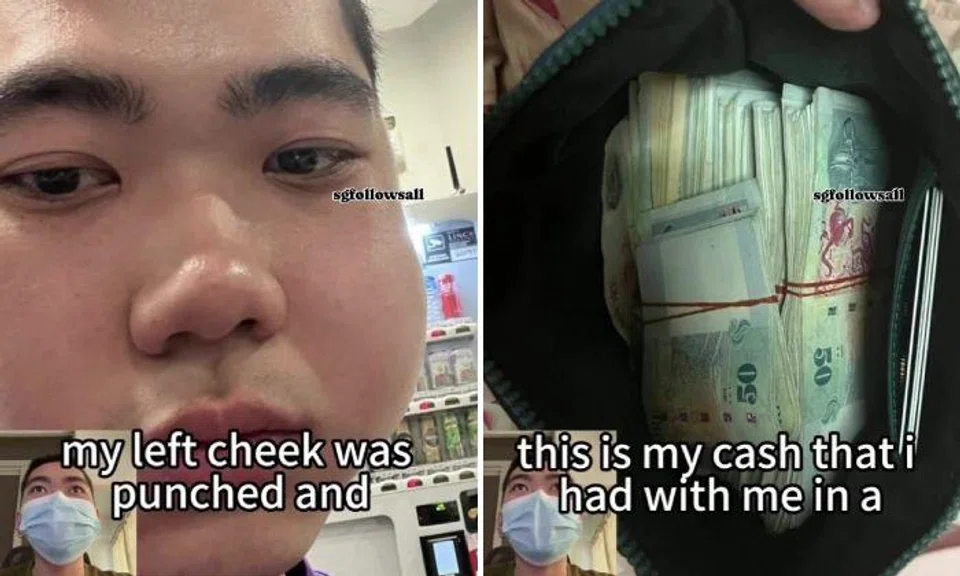 The teen has shared a video online where he recounted what happened. He said he was punched on the left cheek.