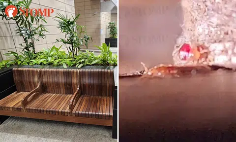 Kids bitten by bedbugs on bench at Outram Community Hospital, SingHealth apologises
