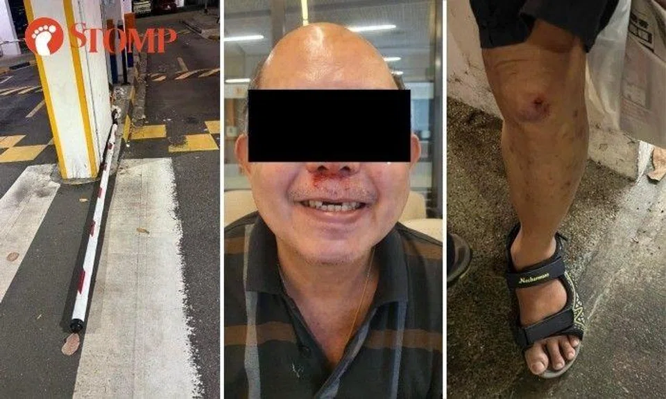 Stomper Grace, who witnessed the man's fall, said he broke his front teeth and his nose was bleeding.