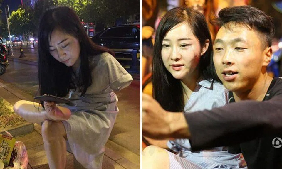 Woman who had arms amputated after horrific accident at 3 years old is latest Internet star
