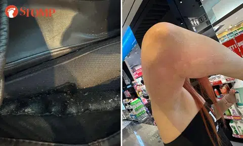 Suntec City visitors discovered that the Rest N Go massage chairs in the mall were infested with bedbugs. 