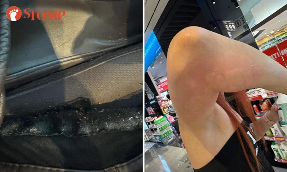 Suntec City visitors discovered that the Rest N Go massage chairs in the mall were infested with bedbugs. 