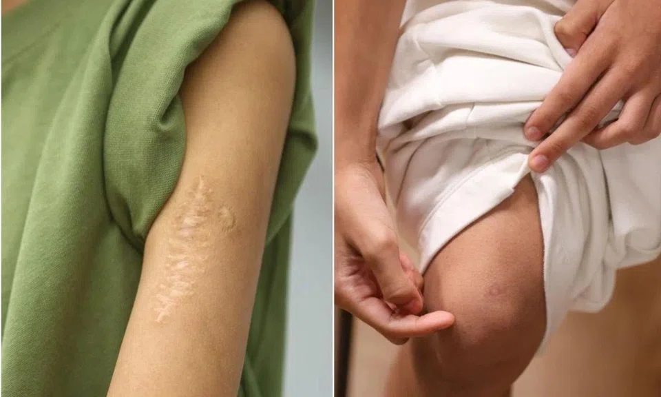 Scars on left arm and right knee.