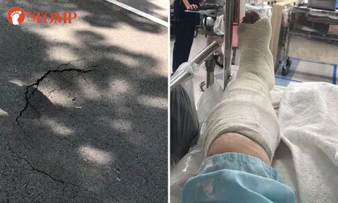 Rider fractures leg after hitting pothole at Ang Mo Kio Industrial Park 2
