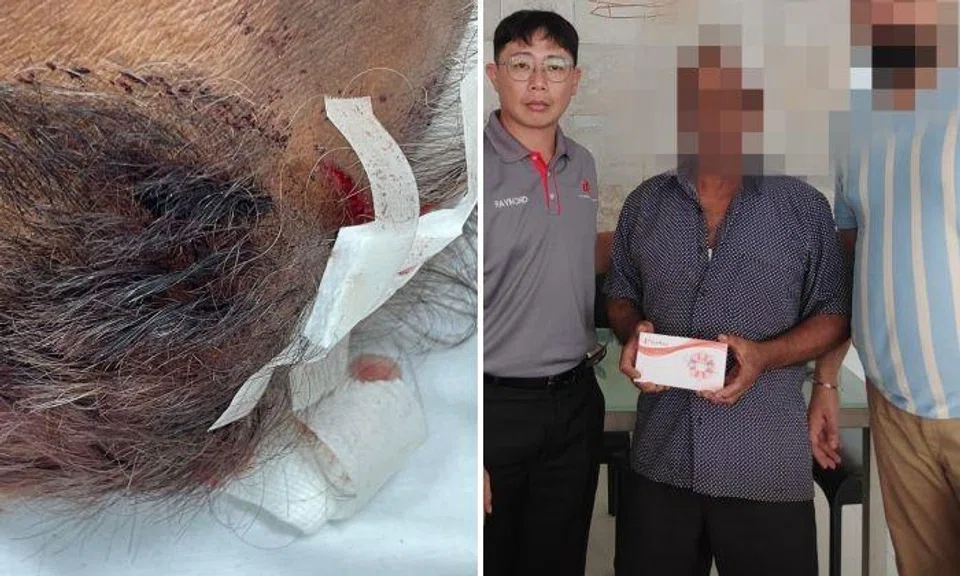Left: The security officer's injury. Right: USE general secretary Raymond Chin (left) visiting the injured security officer (middle).