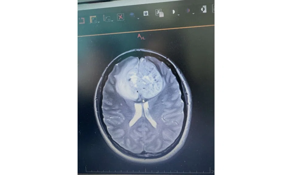 ex-SQ stewardess incurable brain cancer marriage