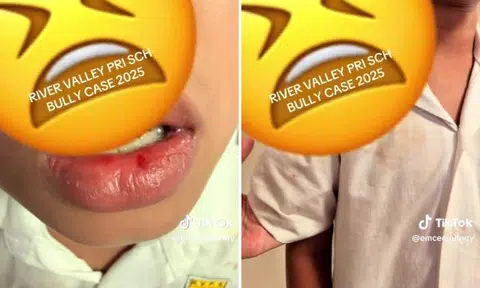 Dad claims Primary 3 son 'punched' by bully, school says boy accidentally hit by friend with wallet