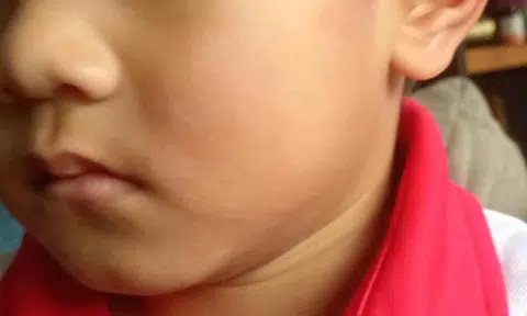 Man arrested for allegedly slapping 4-year-old boy outside Woodlands pre-school